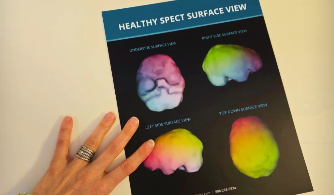 brain imaging for trauma diagnosis