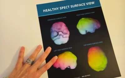 brain imaging for trauma diagnosis